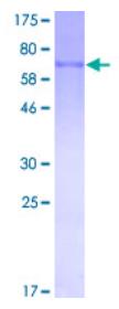 SDS-PAGE (MMP8-5437H).jpg